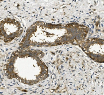 ACTR2 Antibody / Arp2