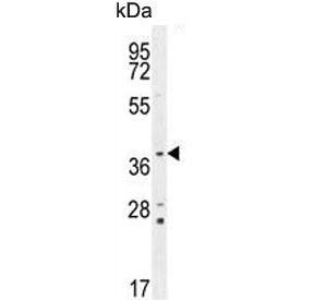 Western blot testing of mouse lung lysate with Twinfilin 2 antibody. Predicted molecular weight ~39 