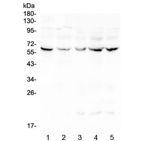 Lumican Antibody / LUM