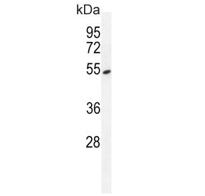 Western blot testing of human A549 cell lysate with Tyrosyl-DNA phosphodiesterase 2 antibody. Expect