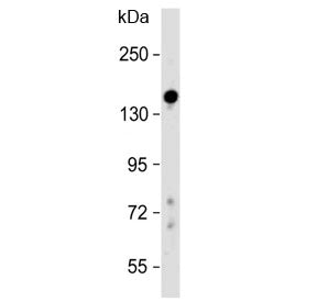 Western blot testing of human liver lysate with Lubricin antibody at 1:500. Predicted molecular weig