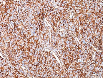 CD44 Antibody / HCAM