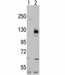Western blot analysis of TRPM8 antibody and 293 cell lysate either nontransfected (Lane 1) or transi