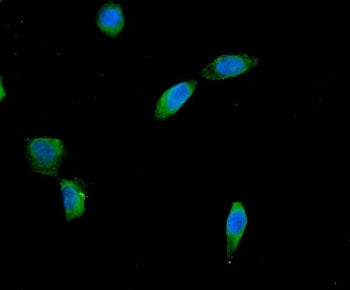 AES Antibody / Amino-terminal enhancer of split