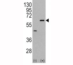 AKT3 Antibody