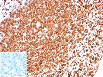 IHC staining of FFPE human tonsil tissue with CD74 antibody (clone CLIP/6609) at 2ug/ml. Negative co