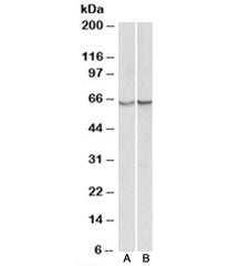 Western blot testing of albumin-depleted serum [A] and plasma [B] lysates with alpha-1-Antichymotryp