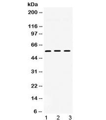 Western blot testing of 1) rat heart, 2) mouse liver and 3) human HeLa lysate with TGF beta receptor