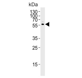 Western blot testing of human BEAS 2B cell lysate with CYP2S1 antibody. Predicted molecular weight ~