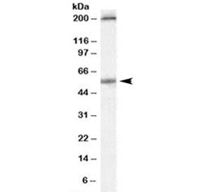 Serotonin Receptor 3A Antibody