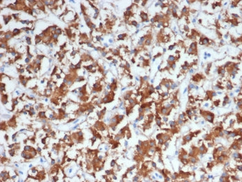 IHC staining of FFPE human adrenal gland tissue with Dopamine Beta-Hydroxylase antibody (clone DBH/7