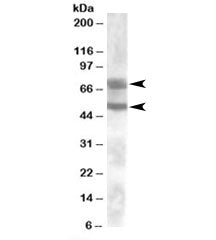 Western blot testing of human kidney lysate with DACH1 antibody at 0.1ug/ml. Predicted molecular wei