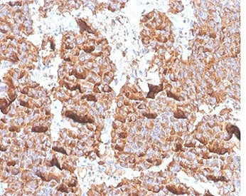IHC staining of FFPE human pituitary tissue with recombinant Prolactin antibody (clone PRL/4906R). H