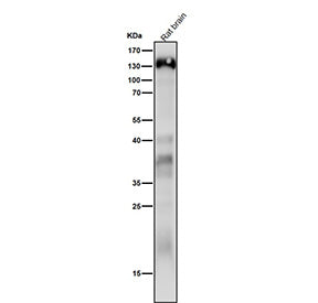 Western blot analysis of Delta 2 Catenin expression in rat brain cell lysate using CTNND2 antibody. Predicted molecular weight ~133 kDa.