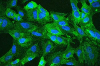 Immunofluorescent staining of FFPE human A549 with ALDH1A1 antibody (green) and DAPI (blue). HIER: b