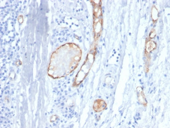 von Willebrand Factor Antibody / vWF