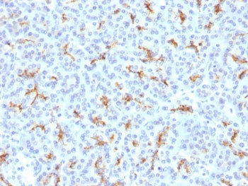 CFTR Antibody / Cystic Fibrosis Transmembrane Regulator