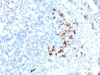IgA Heavy Chain Antibody