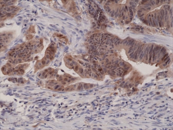 p16INK4a Antibody / CDKN2A