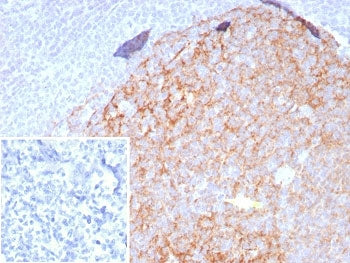 IHC staining of FFPE human tonsil tissue with CD23 antibody (clone FCER2/8509R). Inset: PBS used in 