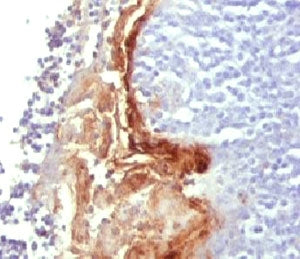 IHC analysis of FFPE human tonsil tissue and Involucrin antibody.