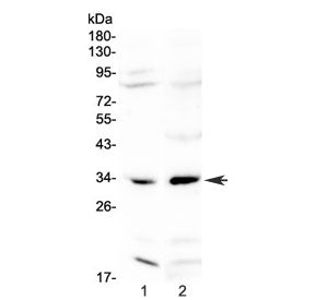 Western blot testing of 1) rat liver and 2) rat ovary lysate with MyD88 antibody at 0.5ug/ml. Predic