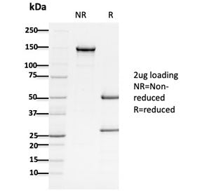 SDS-PAGE analysis of purified, BSA-free Adenomatous polyposis coli antibody (clone ALi 12-28) as con