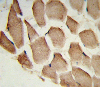 IHC testing of FFPE human skeletal muscle tissue with ARPC1A antibody. HIER: steam section in pH6 citrate buffer for 20 min and allow to cool prior to staining.
