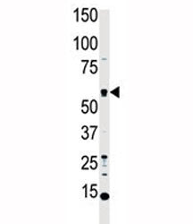 Western blot analysis of MST1 antibody and HL-60 cell lysate. Predicted molecular weight ~ 56 kDa.