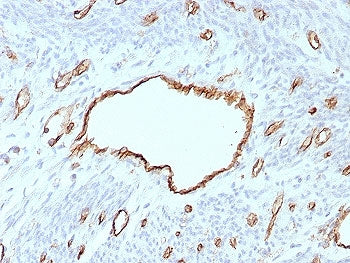 IHC staining of FFPE human uterus tissue with PECAM-1 antibody (clone C31/8593R). HIER: boil tissue 