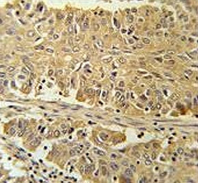PGD Antibody / 6-Phosphogluconate Dehydrogenase