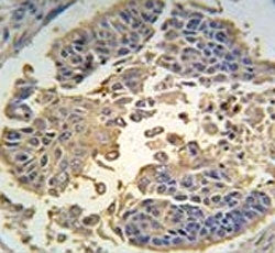 RIPK3 Antibody
