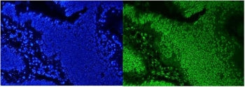 AUF1 Antibody / hnRNP D / HNRNPD