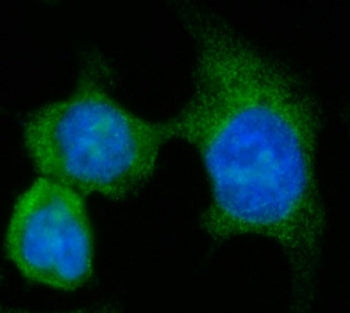 AASS Antibody / LKR / SDH