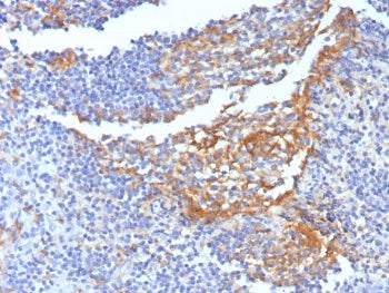 IHC staining of FFPE human tonsil tissue with CD14 antibody (clone LPSR/7738). HIER: boil tissue sec