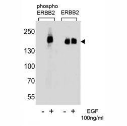 Phos-ERBB2 Antibody (pY1127)