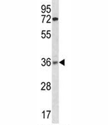 XRCC2 Antibody