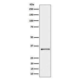 Western blot testing of human A431 cell lysate with Cytochrome b5 reductase 3 antibody. Predicted molecular weight ~34 kDa.