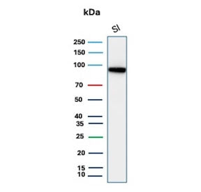 Western blot testing of human small intestine tissue lysate with recombinant CDH17 antibody. Predict