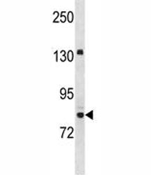 UHRF2 Antibody