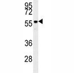 AKT2 Antibody