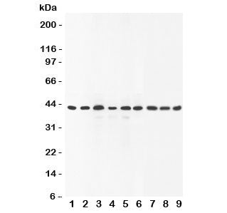 Western blot testing of SOX7 antibody and Lane 1: rat brain; 2: human placenta; 3: (r) lung; 4: (r) 