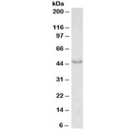 Doublecortin Antibody