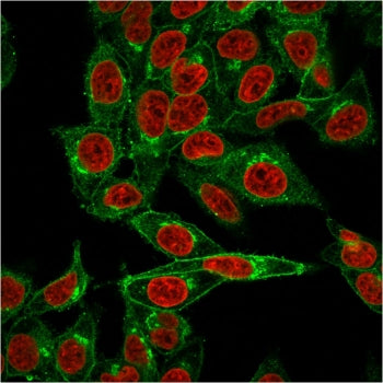 Beta-2 Microglobulin Antibody