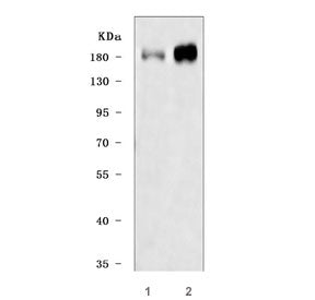 IRS2 Antibody / Insulin receptor substrate 2