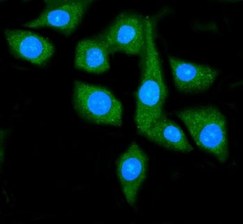Immunofluorescent staining of FFPE human SiHa cells with HSP90AA1 antibody (green) and DAPI nuclear 