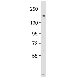 DNA Polymerase alpha Antibody / POLA1 (N-Terminal Region)