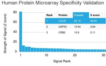 Analysis of HuProt(TM) microarray containing more than 19,000 full-length human proteins using Calbi