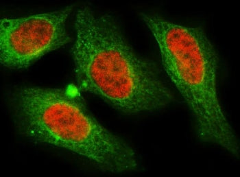 MNAT1 Antibody / CDK-activating kinase assembly factor MAT1