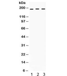 Western blot testing of human 1) SW620, 2) COLO320 and 3) HepG2 cell lysate with LIFR antibody. Expe
